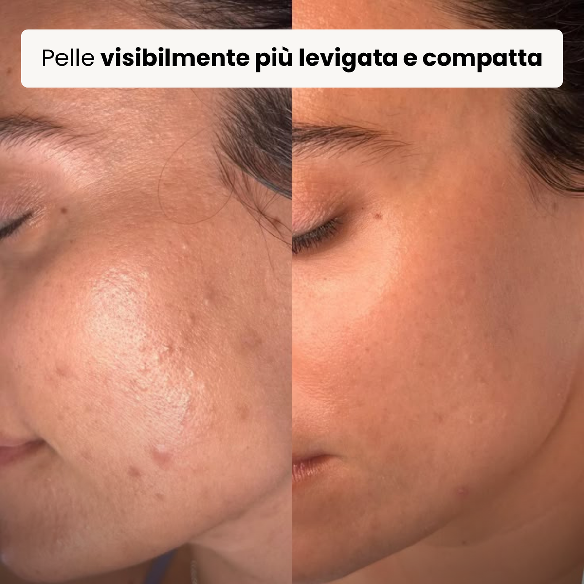 Trattamento Rigenerante Multi-Attivo a base di Bava di Lumaca - Offer 1