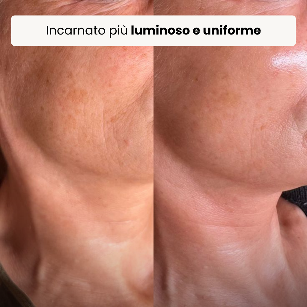 Trattamento Rigenerante Multi-Attivo a base di Bava di Lumaca - Offer 1