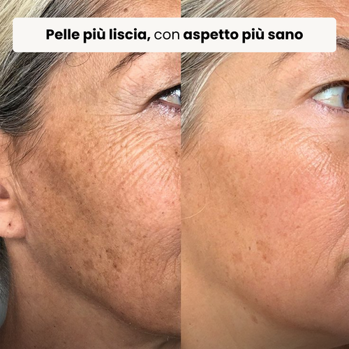 Trattamento Rigenerante Multi-Attivo a base di Bava di Lumaca - Offer 1