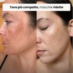 Trattamento Rigenerante Multi-Attivo a base di Bava di Lumaca - Offer 1