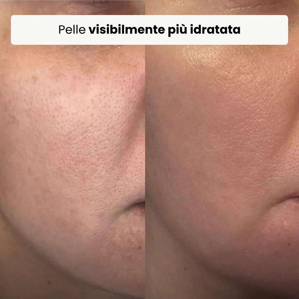 Trattamento Rigenerante Multi-Attivo a base di Bava di Lumaca - Offer 1