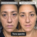 Trattamento Rigenerante Multi-Attivo a base di Bava di Lumaca - Offer 1