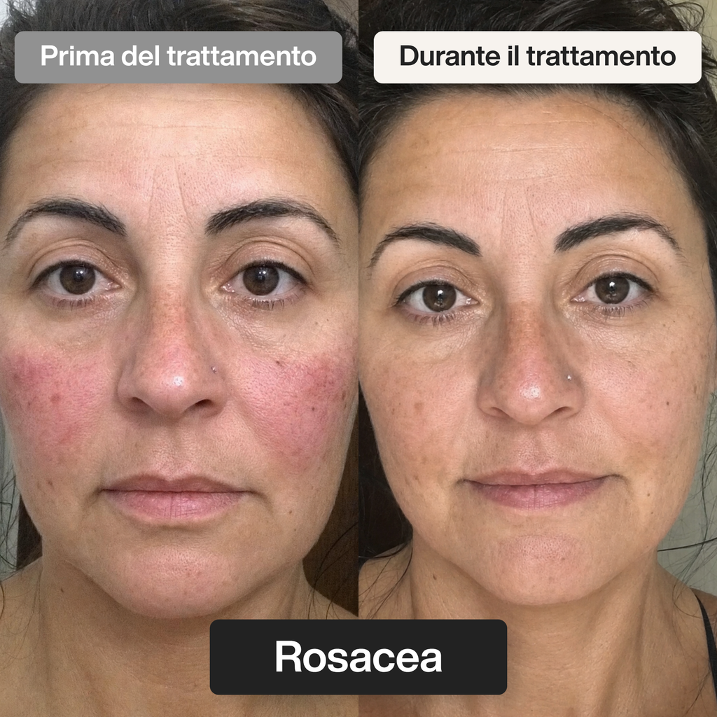 Trattamento Rigenerante Multi-Attivo a base di Bava di Lumaca - Offer 1
