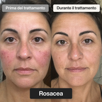 Trattamento Rigenerante Multi-Attivo a base di Bava di Lumaca - Offer 1