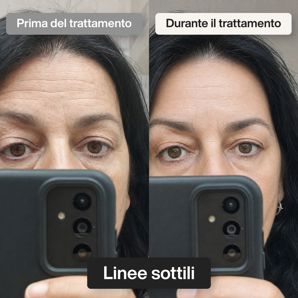 Trattamento Rigenerante Multi-Attivo a base di Bava di Lumaca - Offer 1
