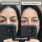 Trattamento Rigenerante Multi-Attivo a base di Bava di Lumaca - Offer 1