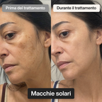 Trattamento Rigenerante Multi-Attivo a base di Bava di Lumaca - Offer 1