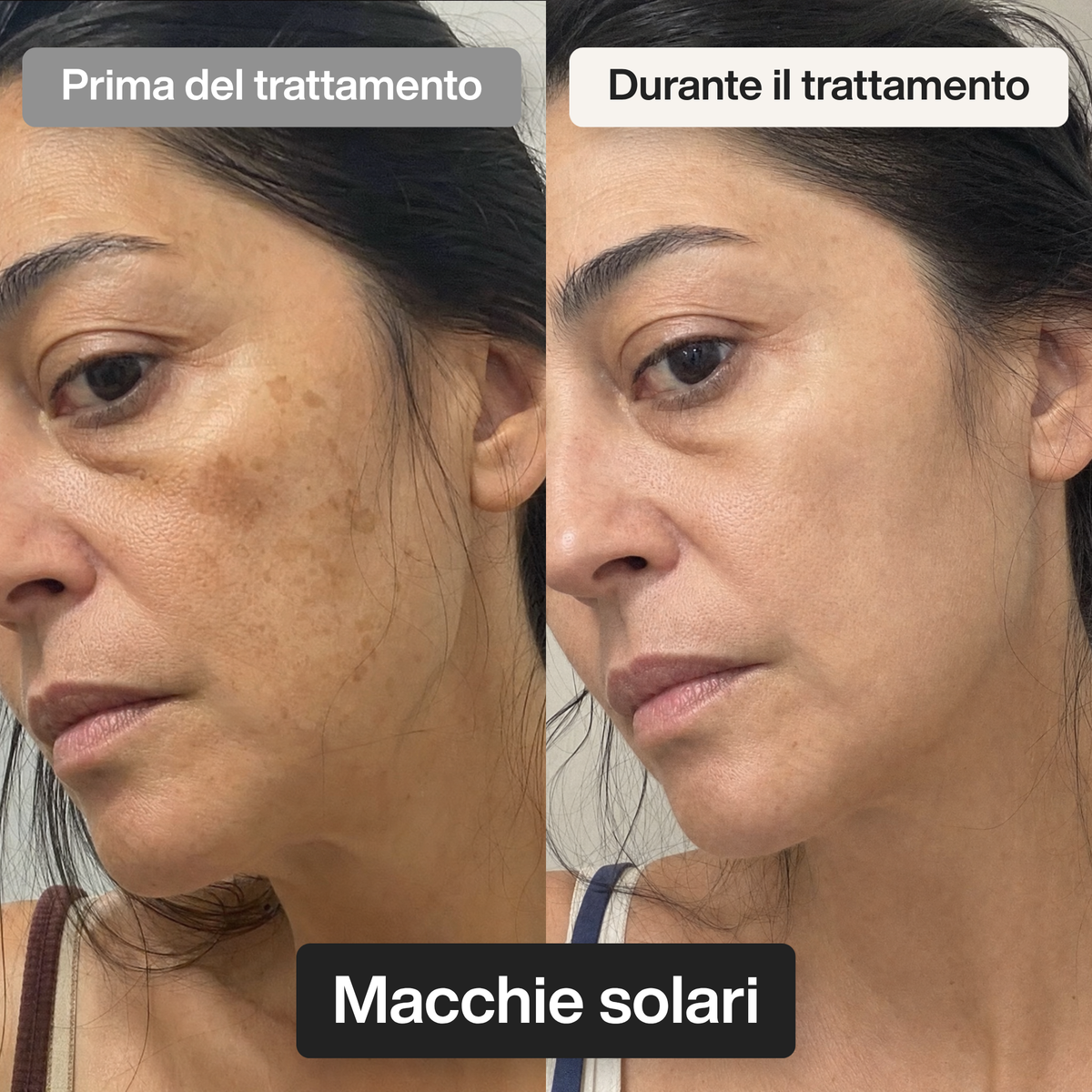 Trattamento Rigenerante Multi-Attivo a base di Bava di Lumaca - Offer 1