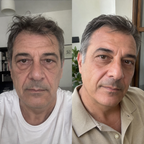 Trattamento Rigenerante Multi-Attivo a base di Bava di Lumaca Uomo